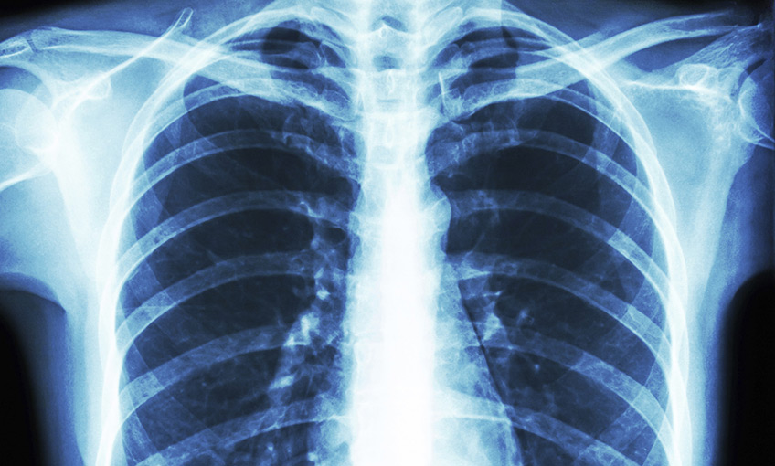 Xray image